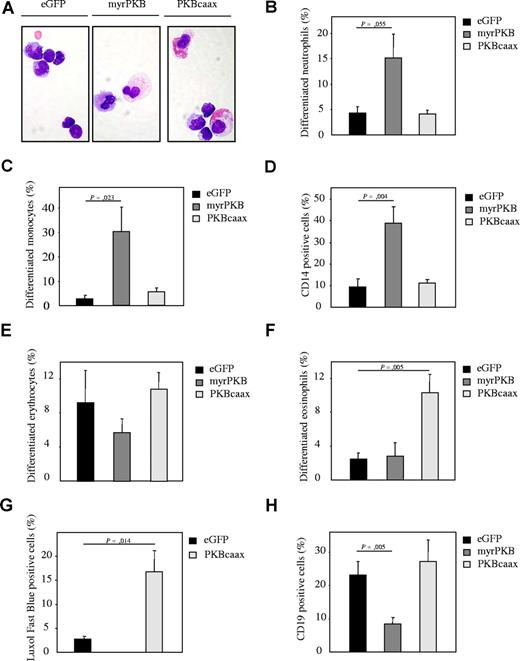 Figure 5. Regulation of PKB activity in human CD34+ hematopoietic progenitors affects lineage development in β2-microglobulin (−/−) NOD/SCID mice. (A) CD34+ cells, cultured in presence of the cytokines SCF, FLT-3, ligand and TPO, were transduced with empty vector alone, myrPKB, or PKBcaax. After 3 days of culture, cells were injected into β2-microglobulin (−/−) NOD/SCID mice. Six weeks after injection, mice were killed, eGFP-positive human cells were sorted, and cytospins were made. Cytospins were stained with May-Grunwald Giemsa solution. Lineage development was depicted as the percentage of (B) neutrophils, (C) monocytes, (D) CD14-positive cells, (E) erythrocytes, and (F) eosinophils within the human, eGFP-positive bone marrow–derived cells. (G) To determine eosinophil development, the eGFP-positive population was sorted from the nontransduced cells and cytospins were made. The percentage of cells differentiated toward eosinophils was determined by Luxol Fast Blue staining, a dye specifically staining for eosinophilic granules. (H) The percentage of CD19-positive cells was determined by FACS analysis to determine B-cell development. Error bars represent SEM.
