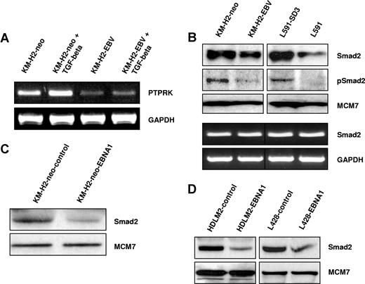 Figure 2. EBV infection or EBNA1 expression inhibits the TGF-beta–mediated activation of PTPRK expression and decreases total and phosphorylated Smad2 protein levels in HL cells. (A) TGF-beta stimulation of KM-H2 HL cells results in the robust up-regulation of PTPRK transcription. However, responsiveness to TGF-beta is reduced by the presence of EBV as demonstrated by a less marked increase in PTPRK transcription in EBV-positive HL cells compared with their EBV-negative counterparts. (B top panel) Immunoblotting shows a reduction in the levels of both total and phosphorylated Smad2 protein in EBV-positive HL cells. (B bottom panel) Semiquantitative RT-PCR demonstrates that SMAD2 transcription is unaffected by the presence of EBV in HL cells. (C) Immunoblotting demonstrates that expression of EBNA1 in EBV-negative KM-H2 cells is sufficient to reduce levels of total Smad2 protein. (D) Immunoblotting shows that expression of EBNA1 in 2 other EBV-negative HL cell lines, HDLM2 and L428, also results in the reduction of total Smad2 protein.