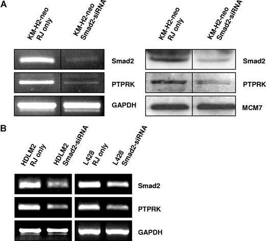 Figure 4. Knockdown of Smad2 expression down-regulates PTPRK expression in EBV-negative HL cells. (A) Semiquantitative RT-PCR for Smad2 and PTPRK mRNA (left panel) and immunoblotting for Smad2 and PTPRK (right panel) in KM-H2 cells show that knockdown of Smad2 expression decreases PTPRK expression. The black dividing lines signify where images from different parts of the same gel have been moved together to bring samples next to each other for direct comparison. (B) Semiquantitative RT-PCR analysis of 2 other EBV-negative HL cell lines (HDLM-2 and L428) shows that PTPRK transcription is also reduced following the knockdown of Smad2 expression in these cells. In all cell lines, transfection with irrelevant siRNA oligonucleotides had no effect on Smad2 or PTPRK expression (data not shown).