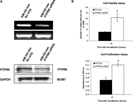 Figure 5. Knockdown of PTPRK expression in EBV-negative KM-H2 cells increases the growth and survival of HL cells. (A) Semiquantitative RT-PCR for PTPRK mRNA (top) and immunoblotting for PTPRK protein (bottom) following siRNA-mediated knockdown of PTPRK expression in EBV-negative KM-H2 cells. (B) Cell viability (trypan blue; left) and cell proliferation (WST-1; right) assays on KM-H2 cells following treatment with PTPRK-specific siRNA. The down-regulation of PTPRK expression in these cells results in a significant increase in cell viability and proliferation (* denotes significant difference; P values are .02 for viability and .003 for proliferation). Transfection with irrelevant siRNA oligonucleotides had no effect on PTPRK expression, cell viability, or proliferation (data not shown).