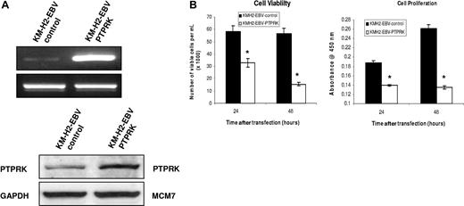 Figure 6. Transient overexpression of PTPRK in EBV-positive KM-H2 cells significantly decreases their growth and survival. (A) Semiquantitative RT-PCR for PTPRK mRNA (top) and immunoblotting for PTPRK (bottom) following overexpression of PTPRK in EBV-positive KM-H2 cells. (B) Cell viability (trypan blue; left) and cell proliferation (WST-1; right) assays on KM-H2-EBV cells following PTPRK overexpression. The transient expression of PTPRK in these cells results in a significant decrease in cell viability and cell proliferation at both 24 and 48 hours (* denotes significant difference; P values are .003 at 24 hours and .001 at 48 hours for viability and P values are less than .001 at both 24 and 48 hours for cell proliferation).
