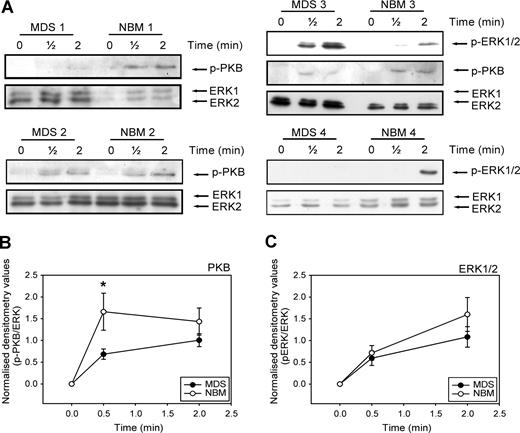 Figure 5. Impaired SDF-1–induced PKB and ERK1/2 activation in MDS CD34+ cells. (A) Isolated CD34+ cells from 9 MDS patients and 9 healthy controls were stimulated with 100 ng/mL SDF-1 for the indicated times. Western blotting was performed using antibodies against phosphorylated PKB (p-PKB, top panels) or phosphorylated ERK1/2 (p-ERK1/2, middle panels). To correct for loading differences the blots were reprobed with antibodies against ERK1/2 (bottom panels). 3 representative examples of PKB activation and 2 examples of ERK1/2 phosphorylation are shown. For quantification of phosphorylated PKB (B) and ERK1/2 (C), densitometry values were divided by the densitometry values of total ERK1/2 protein present in the same samples. Means of 9 independent experiments are shown. Significant differences are indicated with *(P < .05).