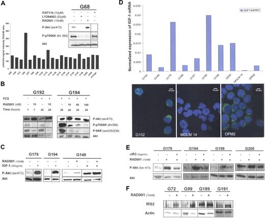 Figure 1. mTORC1 inhibition with RAD001 induces Akt activation in primary AML samples by activation of the IGF-1/IGF1-R signaling pathway, dependent on an IGF-1 autocrine loop. (A) Bone marrow (BM) blast cells from 19 patients with AML were starved for 4 hours in cytokine and serum-free minimal essential medium (MEM), with or without the following kinase inhibitors: 25 μmol/L LY294002, 10 μmol/L IC87114, or 10 nmol/L RAD001, added during the last hour of starvation. Western blots (WBs) were performed with anti-phospho-Akt (ser 473), anti-phospho-p70S6K (thr 389), and anti-Akt antibodies. Quantification of phospho-Akt signal intensity was normalized to Akt signal intensity. Each histogram of the graph represents the phospho-Akt signal intensity in RAD001-treated blast cells, expressed as percentage of signal intensity in control cells (M, medium without inhibitors). (B) BM blast cells from patients G192 and G194 were collected after Ficoll-Hypaque density gradient separation, then washed once in PBS buffer. Blast cells (5 × 105/mL) from patient G192 were starved for 4 hours in cytokine and serum-free MEM, then incubated without or with 10 nmol/L RAD001 for 1 hour. In independent experiments, 5 × 105/mL blast cells from patients G192 and G194 were incubated without or with RAD001 for 24 hours, in α-MEM with 10% fetal calf serum (FCS). RAD was used at 10 nmol/L for sample G192, and at 10, 50, or 100 nmol/L for sample G194. WBs were performed with anti-phospho-Akt (ser 473), anti-phospho-p70S6 kinase (thr 389), anti-phospho-S6R (Ser 235/236), and anti-Akt antibodies. (C) RAD001 increases IGF-1-stimulated Akt phosphorylation in AML blast cells. BM blast cells from patients G179, G194, and G149 were starved for 4 hours in serum-free MEM, without or with 10 nmol/L RAD001, then stimulated or not with 50 ng/mL IGF-1 for 10 minutes. WBs were performed with anti-phospho-Akt (Ser 473) and anti-Akt antibodies. (D) AML blast cells express IGF-1 at the RNA and protein level. BM blast cells from 8 patients were highly purified by flow cytometry cell sorting according to CD45low expression and side scatter. The MOLM-14 AML cell line was used as negative control, and the OPM2 myeloma cell line was used as a positive control for IGF-1 expression. IGF-1 mRNA expression was quantified in the purified blast cells by quantitative RT-PCR, and their levels were expressed relative to HPRT (hypoxanthine phosphoribosyl transferase) mRNA levels. Similar results were obtained using another housekeeping gene, UBCV (C ubiquitin; data not shown). Immunofluorescence staining was performed on purified blasts for the same 8 patients mentioned above, and on MOLM-14 and OPM2 cell lines, using a mouse monoclonal anti-IGF-1 antibody and fluorescein isothiocyanate (FITC)-conjugated goat anti-mouse antibody. Nuclei were stained with 4,6-diamidino-2-phenylindole (DAPI). Images obtained from the representative patient G102 and from MOLM-14 and OPM2 cell lines are presented. (E) The mTORC1-mediated positive feedback on PI3K/Akt activity involves the IGF-1 receptor. BM blast cells from patients G179, G194, G199, and G205 were starved for 4 hours in serum-free MEM. Cells were incubated in the following conditions: medium alone, 10 nmol/L RAD001 for 1 hour, 10 nmol/L RAD001 for 1 hour plus, and 5 μg/mL αIR3 (added 30 minutes before RAD001). WBs were performed with anti-phospho-Akt (Ser 473) and anti-Akt antibodies. αIR3 is a blocking mouse monoclonal antibody directed against the alpha subunit of the IGF-1 receptor and was obtained from Calbiochem. (F) mTORC1 inhibition by RAD001 increases the expression of the IRS2 adaptor. BM blast cells from patients G72, G99, G189, and G191 were starved for 4 hours in serum-free MEM then incubated with or without RAD001 (10 nmol/L) for 1 hour. WBs were performed with anti-IRS2 and anti-actin antibodies.