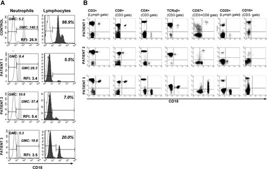 Figure 1. Peripheral blood phenotyping. (A) Flow cytometric detection of CD18 expression of peripheral blood neutrophils and lymphocytes in 3 LAD-1 patients and a healthy control. CD18 expression is shown as histograms. For PMNs, anti-CD18 antibody binding is expressed as relative fluorescence intensity (RFI), defined as geometric mean channel (GMC) fluorescence of CD18 FITC divided by GMC fluorescence of isotype control. For lymphocytes, percentage of lymphocytes staining positive for CD18 is shown. All 3 patients have a lymphocyte population distinctly positive for CD18 compared with the rest of the lymphocyes. The solid peaks represent CD18, while dashed lines represent the isotype controls. (B) Four-color flow cytometry analysis of PBMCs from 3 patients with LAD-1. Backgating and multigating techniques were used to assess coexpression of multiple cell surface markers on CD18+ lymphocytes. CD18 is expressed on the x-axis of all dot plots, while the indicated surface antibody is shown on the y-axis. CD18 was coexpressed with CD3 and CD8 but not with CD4 or CD20. CD18+ T cells did not stain with CD27 or CD28 (data not shown). TCR staining revealed more than 95% TCRαβ+ in the CD3+/CD18+ population. Patients 1 and 2 had small populations of CD18+ cells carrying NK (CD3−/CD56+/16+) cell surface markers (1% and 5% of all CD18+ cells, respectively).