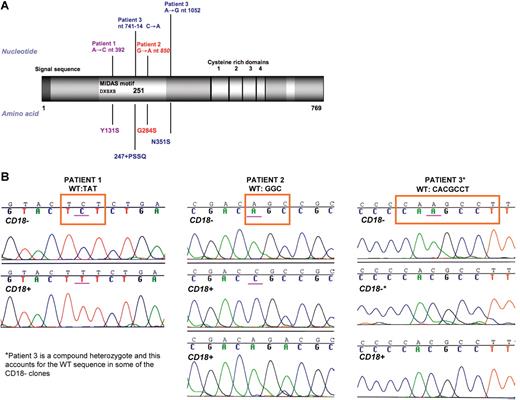 Figure 2. Mutation analysis. (A) Mutations in ITGB2 patients with LAD-1. The 4 mutations in these 3 patients all affect the highly conserved I/A domain of the protein. The numbering of the mutated residues is calculated from the beginning of the signal sequence. (B) Comparison of sequences. CD3+/CD18+ and CD3+/CD18− cells from 3 LAD-1 patients were sorted and genomic DNA was extracted. Mutation sites and surrounding sequence were PCR amplified and subcloned. Clones were sequenced and compared for each patient. All of the 20 CD18+ clones screened for patient 3 had wt intronic sequence. The mutation A>G at nt 1052 was maintained (not shown).