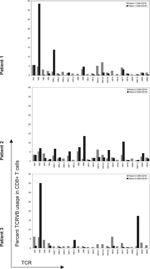 Figure 3. Flow cytometric evaluation of 24 TCRVβ subfamilies in revertant and mutant populations. TCRVβ expression of CD18+ or CD18− CD8+ T lymphocytes for each patient was evaluated by flow cytometry, analyzed using Cellquest software and summarized using bar graphs. Gating is based on CD8+/CD18+ or CD8+/CD18− lymphocytes. CD18+ revertant T cells are represented by black bars; CD18− T cells are represented by gray bars. TCRVβ subset was considered not expressed if it was detected in less than 0.1% of the gated population. For all 3 patients, revertant cells expressed fewer TCR Vβ subsets compared with CD18− T cells. Skewing of TCVβ subfamilies is most prominent in patient 3.