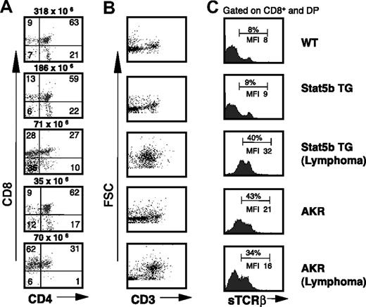 Figure 1. Lymphoblastic lymphoma in Stat5b TG mice. (A) CD4/CD8 profiles in Stat5b TG mice with and without lymphoma are compared with AKR mice with and without lymphoma and a WT control. Numbers indicate the percentage of cells in each quadrant, and total cellularity is indicated above each dot plot. (B) sCD3 expression versus FSC profiles reveals a characteristic pattern in the mice with lymphoma. (C) sTCRβ staining gated on CD8+ cells (CD8 SP and CD4/CD8 DP) is consistent with a T-cell origin of these lymphomas. Numbers indicate the mean fluorescence intensity (MFI) for the CD8+ (SP + DP) populations as well as the percentage within the gated region.