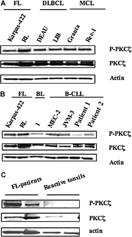 Figure 1. Expression and activity of PKCζ in NHL cell lines. PKCζ expression and activity were evaluated by Western blot using anti-PKCζ and anti–phospho-PKCζ (Thr410/403) in (A) FL (Karpas-422 and RL), DLBCL (DEAU and LIB), and MCL (Granta and Rec-1) cell lines; (B) FL cell lines compared with B lymphocytes from healthy donor (BL), B-CLL cell lines (MEC-2 and JVM-3), and B-CLL patients (patient 1 and patient 2); and (C) tissue extracts from either FL specimen or tonsils. For panels A,B, results are representative of 3 independent experiments.