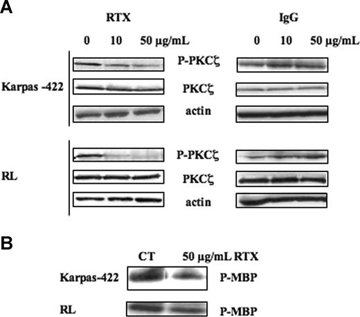 Figure 2. Effect of RTX on PKCζ activity. (A) FL cell lines were treated or not with RTX or IgG at 10 and 50 μg/mL for 24 hours. PKCζ activity was then evaluated by Western blot using anti–phospho-PKCζ antibody. PKCζ was used as control of protein expression. Results are representative of 3 independent experiments. (B) FL cell lines were treated or not with RTX at 50 μg/mL for 24 hours. PKCζ activity was then evaluated by immunokinase assay as described in “Immunokinase assays.” Results are representative of 3 independent experiments.