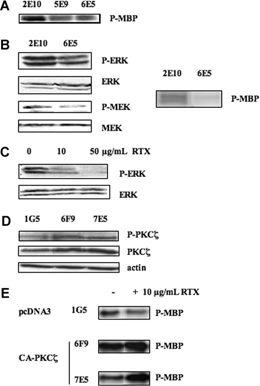Figure 3. Effect of RTX on MAPK pathway. (A) PKCζ activity was evaluated on Karpas-422 stably transfected with pcDNA3 (2E10) or DN-PKCζ (6E5) by immunokinase assay as described in “Immunokinase assays.” (B) (Left panel) The effect of PKCζ inhibition on ERK and MEK activities was evaluated on Karpas-422–transfected clones (2E10 or 6E5) by Western blot using anti–phospho-ERK (Thr202/Tyr204) and anti–P-MEK (Ser217/221) antibodies. MEK and ERK were used as control of protein expression. (Right panel) The effect of PKCζ inhibition on Raf-1 activity was evaluated on 2E10 and 6E5 clones by immunokinase assay as described in “Immunokinase assays.” Results are representative of 3 independent experiments. (C) RL cell lines were treated or not with RTX at 10 and 50 μg/mL for 24 hours, and then ERK activity was evaluated as described in panel B. ERK was used as control of protein expression. Results are representative of 3 independent experiments. (D) PKCζ activity and expression were evaluated on RL stably transfected with pcDNA3 (1G5) and CA-PKCζ (6F9, 7E5) by Western blot using anti–phospho-PKCζ antibody and anti-PKCζ antibodies, respectively. Actin was used as control of protein expression. (E) ERK activity was evaluated by immunokinase assay on RL stably transfected with pcDNA3 (1G5) and CA-PKCζ (6F9, 7E5) treated or not with RTX at 10 μg/mL.