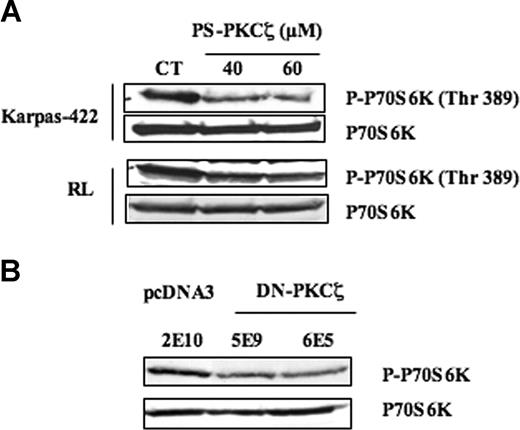 Figure 4. Effect of PKCζ on mTOR. (A) The effect of PKCζ inhibition on mTOR activity was evaluated by Western blot using anti–phospho-p70S6K (Thr389) antibody in FL cells treated with PS-PKCζ at 40 to 60 μM for 30 minutes. p70S6K was used as control of protein expression. Results are representative of 3 independent experiments. (B) The effect of PKCζ inhibition on mTOR activity was evaluated in Karpas-422 cell lines stably transfected with pcDNA3 (2E10) or DN-PKCζ (5E9, 6E5). p70S6K was used as control of protein expression. Results are representative of 3 independent experiments.