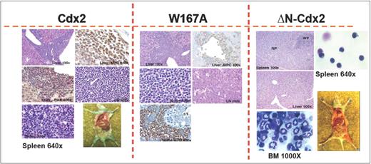 Figure 4. Histology of mice that received transplants. Immunohistologic analyses of different organs of a representative leukemic Cdx2 or W167A-Cdx2 mouse compared with a healthy animal from the ΔN-Cdx2 cohort. The spleen (Giemsa staining, ×640) of the analyzed Cdx2 and W167A-Cdx2 animals shows an infiltration with blast cells in contrast to the ΔN-Cdx2 animal that received a transplant. The liver of the Cdx2 and W167A-Cdx2 mice demonstrates perivascular infiltration with leukemic cells. Positivity for myeloperoxidase (MPO) and chloracetate esterase (CAE) confirmed the myeloid nature of the cells (×100 and ×400). May-Grunwald-Giemsa–stained cytospin preparations of cells isolated from the spleen (×640) or BM (×1000) of ΔN-Cdx2 mice that received transplants show mature lymphoid and myeloid cells, respectively. LN indicates lymph node; RP, red pulp; WP, white pulp; and CAE, chloracetate esterase.