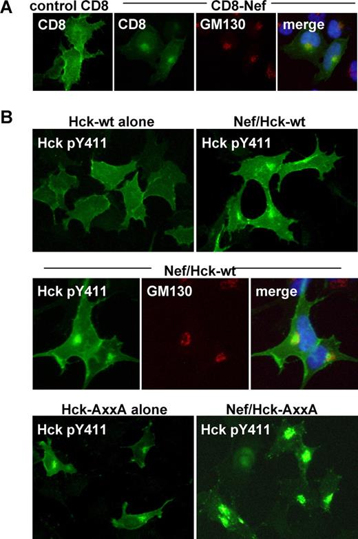 Figure 5. Nef induces Golgi localization of active Hck. (A) Parental 293 cells were transfected with the control CD8 plasmid or CD8-Nef plasmid, and then stained with anti-CD8 antibody (green), anti-GM130 antibody (red), or DAPI (blue). (B) In the top panels, parental 293 cells were transfected with wild-type Hck, or cotransfected with wild-type Hck and Nef, and then stained with the antibody specific for active Hck (ie, Hck phosphorylated at Tyr411). In the middle panels, parental 293 cells cotransfected with wild-type Hck and Nef were costained with anti-Hck pTyr411 antibody (green), anti-GM130 antibody (red), and DAPI (blue). In the bottom panels, parental 293 cells were transfected with the constitutive-active AxxA Hck (see Figure 4B), or cotransfected with the AxxA Hck and wild-type Nef, and then stained with anti-Hck pTyr411 antibody. See “Western blotting, flow cytometry, and immunofluorescence with 293 cells” for image acquisition information.