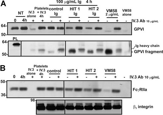 Figure 6. Shedding of either GPVI or FcγRIIa induced by Ig from patients with HIT is blocked by an anti–Fc receptor antibody. Washed platelets were incubated with either VM58 or Ig from control or HIT patient serum. Some samples also contained the blocking anti–FcγRIIa mAb, IV.3 (10 μg/mL, final concentration). Levels of (A) GPVI on platelets (top) or GPVI fragment in supernatant (bottom) or (B) FcγRIIa (top) and β3 integrin (bottom) on platelets were assessed by Western blotting with anti–GPVI mAb (6B-12), anti–FcγRIIa tail antiserum, or the anti-β3 mAb (CRC54) as indicated. Equivalent amounts of VM58 and IV.3 alone or mixed with platelets in the absence of agonist, were run in parallel lanes to distinguish bands corresponding to Ig heavy chains. PL indicates platelet lysate, containing full-length GPVI for reference. Vertical lines have been inserted to indicate a repositioned gel lane. All lanes within each figure came from the same experiment and the same gel/Western blot.