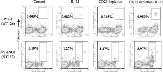 Figure 2. Combined use of IL-21 and CD25 depletion enhances generation of WT-1– and NY-ESO-1–specific CTL responses. Unmanipulated or CD25-depleted PBMCs from an HLA-A2+ patient with a WT-1+ ovarian cancer (top panels) and a patient with melanoma (NY-ESO seropositive; bottom panels) were stimulated as described in Figure 1.