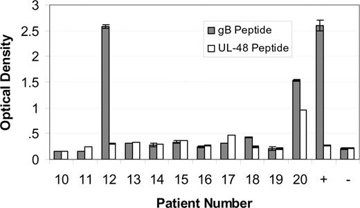 Figure 5. Immunoreactivity of paraproteins. Immunoreactivity of paraproteins from patients 10 to 20 with a synthetic peptide corresponding to the AD-2S1 epitope of glycoprotein B human herpesvirus 5 () or with a synthetic peptide corresponding to the amino terminus (amino acids 1-20) of the UL-48 gene product (). MM patient sera were diluted 1:1250 so as to fall within the assay linear range. An HCMV-immunoreactive serum was used as a positive (+) control. A nonreactive serum was used as a negative control (-). Since patients 12 and 20 are our index patients, we randomly included MM patients 10 to 20 in the immunoassay, for comparison. The patient selection is random, since the patient number designation is assigned in order of specimen acquisition. Samples were measured in duplicate. The mean plus or minus the standard deviation are shown.