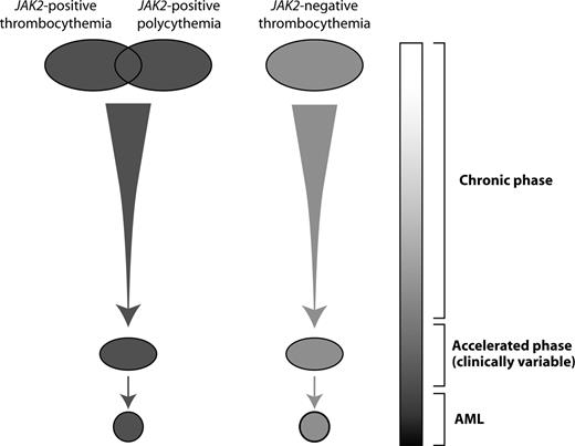 Figure 5. A model for the myeloproliferative diseases. JAK2-positive polycythemia and thrombocythemia overlap and can progress to an accelerated phase. This can be clinically variable, with myelofibrotic transformation, cytopenias, increased blasts, and increased white cells potentially present. JAK2-negative disease follows similar patterns of progression and is biologically distinct from V617F-positive disease. Under this model, patients currently labeled as having primary myelofibrosis may in fact represent persons in the accelerated phase of a preexisting MPD.