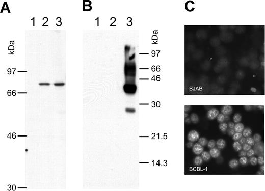 Figure 1. vIRF-3 is constitutively expressed in primary effusion lymphoma cells. Whole-cell lysates from the human KSHV− B-cell line BJAB (lane 1), KSHV+ BCBL-1 cells (lane 2), and BCBL-1 cells activated by TPA for 4 days (lane 3) were separated on 8% (A) or 12% (B) discontinuous SDS–polyacrylamide gels. Separated proteins were transferred onto nitrocellulose membranes and incubated with either monoclonal antibody 3G7 generated against a N-terminal fragment of vIRF-3 (A), or antibody BS555 directed against the virion glycoprotein K8.1.45 Whereas the various forms of gpK8.1 were abundantly expressed in BCBL-1 cells induced with TPA (panel B lane 3) and not detectable without induction (panel B lane 2), the relatively moderate expression level of vIRF-3 remains essentially unaltered by TPA treatment (panel A lanes 2-3). The immunofluorescence in panel C shows that vIRF-3 is present in the nuclei of latently infected BCBL-1 cells. BCBL-1 cells (lower photomicrograph) or KSHV− BJAB cells were fixed onto glass slides and incubated with monoclonal antibody 3G7 directed against recombinant vIRF-3, followed by detection with fluorescein-labeled antibodies against rat IgG. A fine-grained nuclear fluorescence was clearly detectable in virtually all BCBL-1 cells, but not in the KSHV− human B-cell line BJAB.