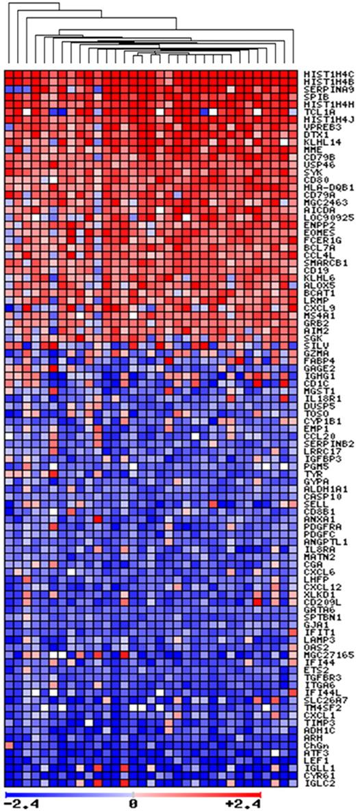 Figure 1. Follicular lymphoma signature. Heat map showing the gene expression profile data of 33 FL cases normalized with follicular hyperplasia cases. Red indicates high level of expression in tumors versus normal cells; blue indicates low-level expression. Genes were ranked according to mean intensity of expression. With the exception of histone subunits, GCET1 (Serpina9) expression was, in absolute numbers, the strongest of all the genes included in the FL signature. Note the stronger expression of GCET1 compared with other well-established GC markers, such as MME (CD10) and BCL6 (not shown in the figure), and novel GC markers, such as KLHL 6 and DTX1.