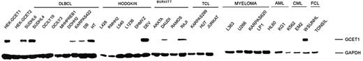 Figure 3. Gcet1 expression by Western Blot. Western blot results of Gcet1 from transfected and lymphoma cell lines. The first 2 rows demonstrate the specificity of anti-Gcet1 on lysates of transfected HEK-GCET1 cell lines. A 46-kDa band specific to the Gcet1 protein was observed in GC-DLBCL (SUDHL4 and SUDHL6), FL (WSUNHL), and some other DLBCL (KARPAS 422, DB, and HT) and BL (RAJI and DAUDI) cell lines. The Gcet1 protein was not present in a subset of DLBCL (MHHPREB1, DOHH2), some BL (AKATA, RAMOS), PTL (KARPAS299, HUT78, JURKATT), myeloma (L-363, U226, KARPAS-620, LP-1), AML (HL60, KG1), or CML (K562, EM2) cell lines. The NLPHL-derived DEV cell line was strongly positive, whereas those derived from cHL (L428, KMHH2, L540, L1236, and DHMYZ) showed no specific band. The GAPDH band was used as an internal reference.