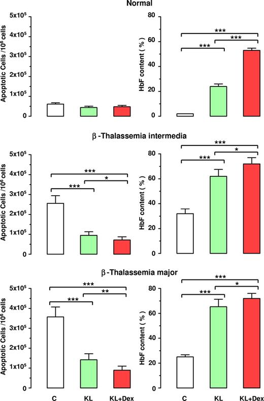 Figure 5. Inverse correlation between apoptosis and HbF reactivation in β thalassemia. Evaluation of apoptotic cells (left panels) and HbF content (right panels) at terminal erythroid differentiation in normal, β-TI, and β-TM HPC cultures supplemented or not with KL (100 ng), alone or in combination with Dex (10−8 M). Mean (± SEM) values from 7 separate experiments on 7 different donors are reported. Variance analysis was expressed as Bonferroni P values. *P < .05, **P < .01, ***P < .001.