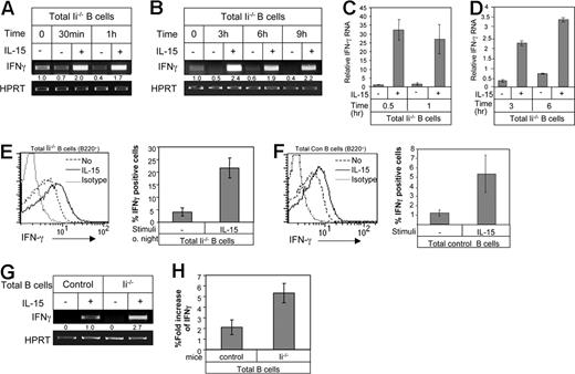 Figure 2. IL-15 induces IFN-γ production by B cells. (A,B) Total B cells (B220+) from Ii−/− mice (immature) were suspended in 5 mL RPMI plus 10% FCS and incubated in the presence or absence of IL-15 (30 ng/mL) for various time periods as indicated. RT-PCR using primers for IFN-γ and HPRT was performed as described in “RNA isolation and reverse transcription.” (C,D) Total B cells (B220+) from Ii−/− mice (immature) were suspended in 5 mL RPMI plus 10% FCS and incubated in the presence or absence of IL-15 (30 ng/mL) for various time periods as indicated. Quantitative real-time PCR was performed using primers for IFN-γ and HPRT as described in “Quantitative real-time RT-PCR.” Results shown are representative of 3 separate experiments. (E,F) Total lymphocytes from Ii−/− mice (E) or control mice (F) were incubated in the presence or absence of IL-15 (30 ng/mL) overnight. The cells were stained for B220, and IFN-γ protein levels were analyzed by intracellular staining as described in “Intracellular staining.” The graphs show the percentage of B220+ and IFN-γ+ B cells minus the background of cells stained with an isotype control antibody. (G) Total B cells from control (mature) and Ii−/− (immature) mice were suspended in 5 mL RPMI plus 10% FCS and incubated in the presence or absence of IL-15 (30 ng/mL) for 1 hour. RNA was isolated and subjected to RT-PCR was preformed using primers for IFN-γ and HPRT as described in “RNA isolation and reverse transcription.” (H) Total lymphocytes from control and Ii−/− mice were incubated overnight in the presence or absence of IL-15 (30 ng/mL) and stained for B220, and IFN-γ levels were analyzed by intracellular staining. The graph shows the fold increase in IFN-γ protein levels following treatment in the 2 populations. The results are representative of 3 separate experiments. Error bars represent SD.
