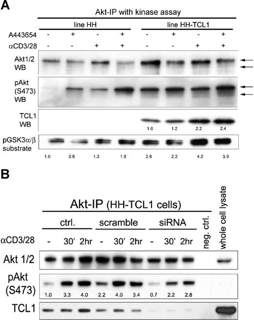 Figure 5. TCL1 introduction into leukemic T cells influences AKT phosphorylation and kinase activity. (A) Transfection of TCL1 into the sTCR+ mature T-cell leukemia line HH augmented baseline and TCR-induced AKT phosphoactivation, and increased phosphorylation of the AKT target GSK3α/β (2.6-fold at baseline and 1.3- to 4.2-fold TCR induced). Similar to primary T-PLL tumor cells, TCR cross-linking also increased the amount of TCL1 complexed with AKT by 2.2-fold. Preincubation of tumor cells with the AKT inhibitor A443654 at 0.5 μM leads to slightly decreased GSK3α/β phosphorylation, and a compensatory pAKT increase (kinase assay and Western blot following AKT immunoprecipitation). Indicated are fold changes over the unstimulated DMSO vehicle control. (B) Transient knockdown of TCL1 in the HH-TCL1 cell line reduced baseline levels of activated pAKT in immunoprecipitated complexes compared with control HH-TCL1 (down to 0.7-fold) or cells transfected with scrambled siRNA (assayed at 72 hours). TCL1 knockdown also reduced levels of activated pAKT following TCR engagement for 30 minutes and 2 hours at these time points (ie, 3.3- to 2.2-fold after 30 minutes of simulation).
