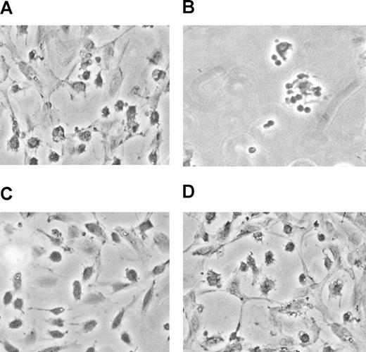 Figure 1. CMV-seropositive donor PBMCs exposed to CMV antigen results in endothelial cell damage in cocultures. (A) PBMCs isolated from a CMV-seropositive donor and cocultured with endothelial cells after 5 days are shown. (B) The same donor PBMCs cocultured on endothelial monolayers for 5 days are shown, in the presence of CMV antigen. (C) Control in which endothelial monolayers alone were maintained for 5 days. (D) CMV-seronegative donor PBMC exposed to the same conditions had no effect on endothelial cell monolayers and are indistinguishable from panel C. Results are representative of 6 different CMV-seropositive and -seronegative donor pairs.