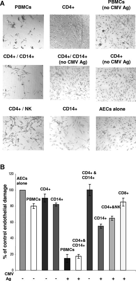 Figure 6. Endothelial damage is associated with CD14+ or NK populations. (A) Endothelial damage by CMV antigen–stimulated PBMC subset populations shows NK and CD14+ monocyte-macrophage populations associated with damage after 5 days of coculture. Negative controls without CMV antigen stimulation are indicated. (B) Endothelial damage assays per subset populations in which results were quantitated by counting remaining endothelial cells per field of view (FOV) under the microscope (20× objective). Results are representative of 3 independent assays, each with different CMV-seropositive donors. Error bars represent SD.