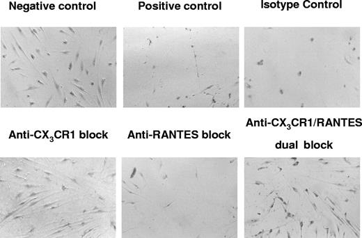 Figure 7. CMV-seropositive donor PBMCs exposed to CMV antigen results in endothelial damage in cocultures that is mediated predominantly by the fractalkine-CX3CR1 interaction. Each micrograph panel shows the resulting effects of specific neutralizing antibody blocks and controls on CMV-induced endothelial damage in PBMC-AEC cocultures at day 6. Negative control was transmigrated PBMC populations using negative control media lacking chemokines; positive control was transmigrated PBMCs using untreated coculture supernatants; isotype control was PBMCs treated with isotype control antibodies for CX3CR1-specific and RANTES-specific neutralizing antibodies, followed by transmigration into coculture supernatants; anti-CX3CR1 block was PBMCs treated with neutralizing antibody specific for CX3CR1, followed by transmigration into coculture supernatants; anti-RANTES block was PBMCs treated with neutralizing antibody specific for RANTES, followed by transmigration into coculture supernatants; dual block was PBMCs treated with both neutralizing antibody specific for CX3CR1 and neutralizing antibody specific for RANTES, followed by transmigration into coculture supernatants. Extensive endothelial damage and loss are seen in positive control, isotype control, and anti-RANTES block. In contrast, protection against endothelial damage is observed in the presence of the anti–CX3CR1-blocked samples.