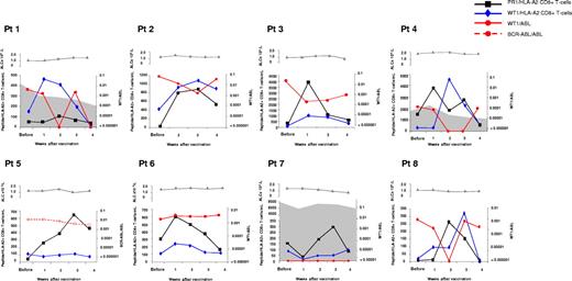 Figure 3. PR1- and WT1-specific CD8+ T-cell responses in peripheral blood in relation to disease response as measured by WT1/ABL and BCR-ABL/ABL gene expression. Results in 8 individual patients are shown. Weeks after vaccination are shown on the x-axis. PR1/HLA-A*0201+ (black square and connecting line) and WT1/HLA-A*0201+ (dark blue diamonds and connecting line) CD8+ T cells are expressed as absolute numbers per milliliter of peripheral blood (left y-axis); the shaded area represents absolute numbers of CMVpp65495/HLA-A*0201+ CD8+ T cells. The absolute lymphocyte count (gray triangle and connecting line) is expressed as absolute number per liter of peripheral blood (left y-axis); WT1 and BCR-ABL gene expression in peripheral blood is expressed as the ratio of WT1/ABL (red circles and connecting line) and BCR-ABL/ABL (red circles and dashed connecting line) (right y-axis).