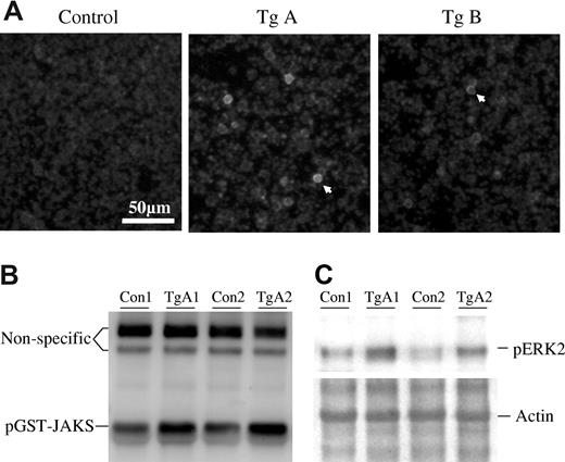 Figure 2. Detection of JAK2V617F protein levels and activities in transgenic mice. (A) Peripheral blood white cells from line A and B transgenic mice and their nontransgenic siblings were attached to polylysine-coated coverslips, fixed with formaldehyde, and then stained with an anti-JAK2 antibody (Cell Signaling Technology, Danvers, MA) and further probed with a Cy3-conjugated antirabbit secondary antibody. Photos were taken with a 40× objective. The arrowheads point to positively stained cells. (B) Cell extracts from bone marrow (after red cell lysis) of 2 nontransgenic control and 2 line A transgenic mice were analyzed for JAK2 tyrosine kinase activity with GST-JAKS as a substrate as described earlier.25 Detections were made using an antiphosphotyrosine antibody. Equal protein loadings are indicated by 2 irrelevant (nonspecific protein) bands recognized by the antibody. (C) Analyses of ERK activation in bone marrow cells from 2 nontransgenic control and 2 line A transgenic mice with anti-pERK antibody (Cell Signaling Technology). Coomassie blue staining of the PVDF membrane revealed equal amounts of actin, indicating equal protein loadings. Note that actin and ERK2 have similar molecular size.