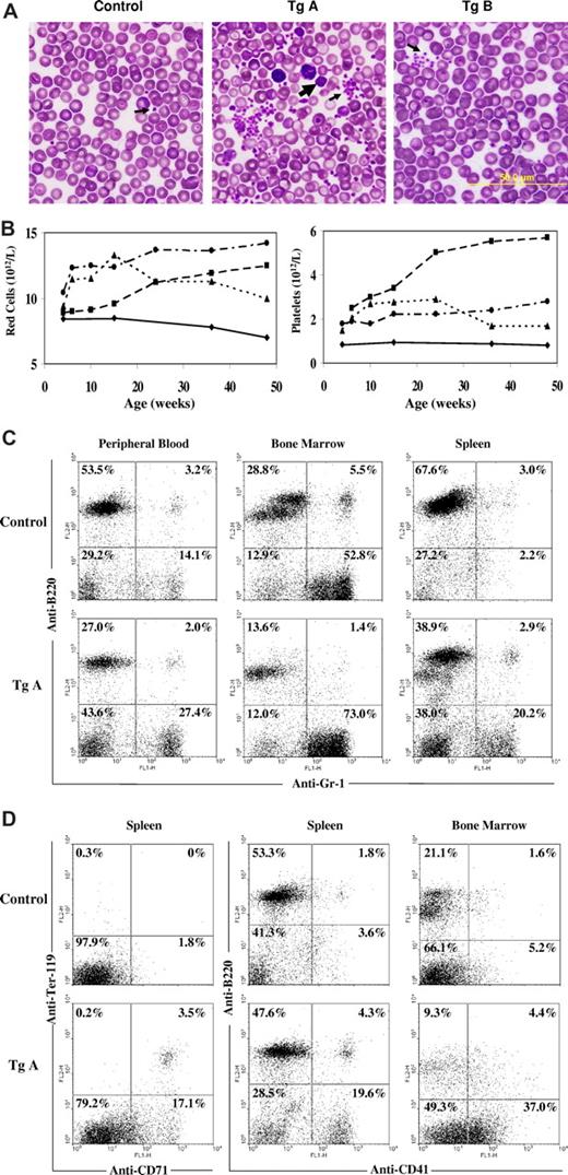 Figure 3. Analyses of hematopoietic cells of JAK2V617F transgenic mice. (A) Blood cell smears stained with the Wright and Giemsa reagent. Arrows point to platelets. The big arrow indicates a giant platelet. (B) Blood cell counts of a representative nontransgenic control (—) and 3 line A transgenic ( and …) mice at different ages. (C,D) Flow cytometric analyses of peripheral blood, bone marrow, and spleen cells from nontransgenic and line A transgenic mice. Cells were stained with phycoerythrin-conjugated anti-B220 and fluorescein isothiocyanate-conjugated anti-Gr-1, anti-Ter119, anti-CD71, or anti-CD41. Percentages of cells in each quadrant are indicated.