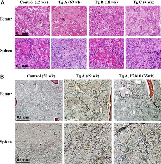 Figure 5. JAK2V617F transgenic mice display megakaryocytic hyperplasia and develop fibrosis. Hematoxylin and eosin (A) and reticulin (B) staining of paraffin-embedded sections of spleen and femur (for bone marrow) from control and transgenic mice. Photos in panel A are representative results obtained with all 3 lines of transgenic mice, whereas those in panel B represent selected cases of line A mice that developed fibrosis. Arrows point to typical megakaryocytes, which are not present in the spleen of control mice. Pictures were taken with a 40× objective.