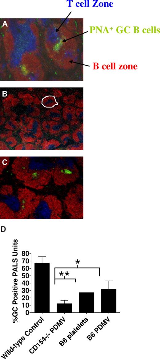 Figure 5. B6 PDMVs enable a limited number of normal B6 CD4+ T cells to induce GC reactions in CD154−/− mice depleted of platelets. Platelets were depleted using 10 μg p0p3/4 24 hours before intravenous adoptive transfer of 4 × 106 negatively selected, naive B6 CD4+ T cells intravenously and 108 B6 platelets, B6 PDMV from 5 × 108 platelets, or CD154−/− PDMV from 5 × 108 platelets. Twelve days after injection, spleens were harvested and processed for histologic examination of frozen sections. Blue represents T-cell zone (anti-CD4 and CD8 staining); red, B-cell follicles (anti-B220); green, peanut agglutinin (PNA; GC B cells stain PNAhi). GCs are visualized as B220 PNA double-positive (green-yellow) areas of cells. Representative histology from the wild-type control consisting of B6 mice immunized with adenovirus alone (A) and CD154−/− mice immunized with adenovirus and treated with naive B6 CD4+ T cells with CD154−/− PDMV (B) or B6 PDMV (C). GCs were visualized and reported as GCs/PALS (D). A PALS unit consists of the follicular and T-cell zones surrounding a central arteriole. An example of a PALS unit is delineated in panel B with a dashed white line. The experiment was performed with 5 mice per group and repeated once (*2-tailed P = .014; **2-tailed P = .058).