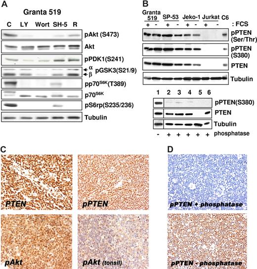 Figure 2. Akt constitutive activation correlates with the expression of phosphorylated/inactive form of PTEN. (A) The PI3-K/Akt cascade in MCL cell lines. Granta 519 cells were cultured in serum-free medium for 6 hours with solvent alone (“C”), 50 μM LY294002 (“LY”), 1 μM wortmannin (“Wort”), 20 μM SH-5, or 0.1 μM rapamycin (“R”). Total-cell lysates corresponding to 100 μg of proteins were analyzed by immunoblotting for the indicated proteins. Comparable results were also obtained in SP-53 and Jeko-1 cells (not shown). (B) MCL cell lines express the phosphorylated, inactive form of PTEN. All 3 cell lines investigated were cultured in medium with 10% FCS or medium with 0.5% BSA for 24 hours. Total-cell lysates, corresponding to 100 μg of proteins, were subjected to immunoblotting analysis using specific antibodies to the phosphorylated form of PTEN on Ser380 and Thr382/383. To check the antibody specificity after Western transfer, the membrane (bottom panel) was treated with CIAP for 3 hours at 37°C. Lane 1 was cut before CIAP treatment and used as positive control for the phosphospecific antibody. The samples are Granta 519 (lanes 1 and 2), SP-53 (lane 3), Jeko-1 (lane 4), Jurkat (lane 5), and C6 (lane 6). The Jurkat cell line was used as negative control for PTEN protein expression,10 and the C6 cell line was included as positive control. (C) Immunohistochemistry (magnification, ×400). PTEN protein expression is retained in all MCL cells (top left panel), which also expresses its phosphorylated form (top right panel). Most MCL cells show intense phospho-Akt nuclear signal (bottom left panel), whereas weak nuclear and cytoplasmic staining is evident in reactive mantle and germinal center lymphocytes (top right panel). (D) Original magnification, ×200. Staining with phospho-PTEN (Thr380) of samples treated (top) and untreated (bottom) with calf intestinal alkaline phosphatase for 45 minutes at 37°C. Images were acquired with a Nikon E80i microscope (Nikon, Tokyo, Japan) equipped with a Plan APO 20×/.075 objective and Nikon DS camera. ACT-1 software was used for image processing.