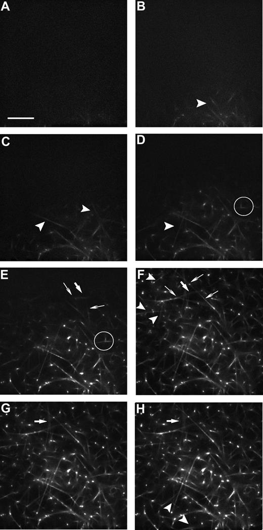 Figure 1. Series of micrographs from the deconvolution microscope showing the dynamics of fibrin network formation. Fibrin was labeled with Alexa 488 as described in “Labeling of fibrinogen with Alexa 488.” Images were taken every 10 seconds (Videos S1,S2, available on the Blood website; see the Supplemental Materials link at the top of the online article). Selected images at the following times are shown: (A) 3 minutes and 50 seconds, (B) 4 minutes, (C) 4 minutes and 10 seconds, (D) 4 minutes and 20 seconds, (E) 4 minutes and 40 seconds, (F) 5 minutes, (G) 6 minutes, and (H) 20 minutes. Arrowheads () indicate new fibers. Thick arrows (↙) indicate fibers that change position. Thin arrows (↑) indicate fibers that change length. The circled area shows a single-fiber with a branch point that is not connected to the scaffold in panel D, but it has connected to the scaffold later, as in panel E. Bar represents 15 μm.