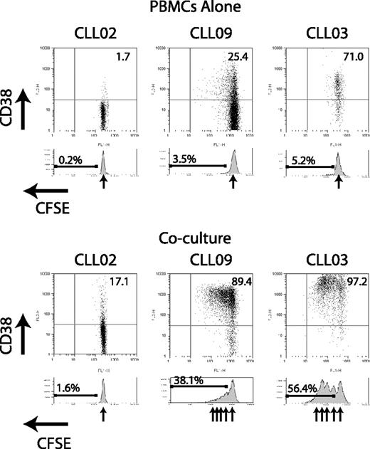 Figure 3. Coculture of CLL cells with activated autologous T cells can result in CLL cell division in addition to CD38 up-regulation. CLL cells were labeled with CFSE and incubated with activated autologous T cells for 4 to 6 days. At the end of the culture period, the samples were analyzed by flow cytometry using CD19 expression to identify CLL cells. Flow cytometer plots gated on CD19+ cells are shown from 3 representative patient samples. Residual CLL PBMCs cultured alone show only a single CFSE peak, indicating no cell division. In the case with initial low CD38 expression (CLL02), coculture shows CD38 up-regulation but no division. In 2 cases with initial positive CD38 expression (CLL09 and CLL03), both CD38 up-regulation and division are seen in coculture.