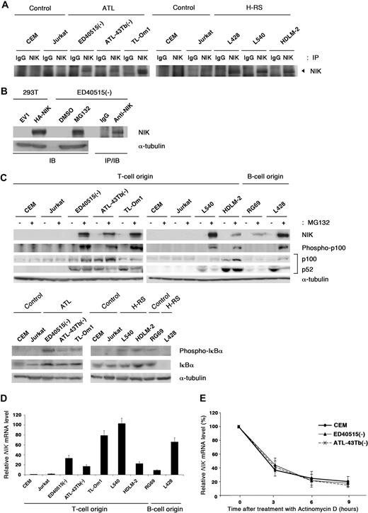 Figure 1. NIK protein is overexpressed in established ATL and Hodgkin Reed-Sternberg cells. (A) Steady-state levels of NIK expression in the ATL and H-RS cell lines were revealed by immunoprecipitation-coupled immunoblotting. Approximately 2 × 107 cells were lysed with buffer A. After preclearing, immunoprecipitation was performed at 4°C, using anti-NIK antibody (NIK) or its isotype IgG (IgG). After 3 washes with TNT buffer, immune complexes were analyzed by immunoblotting with anti-NIK antibody. (B) 293T cells were transfected with pMRX-HA-iresPuro or pMRX-HA-NIKiresPuro for 24 hours. Whole-cell lysates were used as negative and positive controls. ED40515(−) cells were pretreated with (+) or without (−) MG132 (20 μM) for 3 hours, lysed with RIPA buffer, and subjected to immunoblotting with anti-NIK or anti-α-tubulin antibodies. Immunoprecipitation-coupled immunoblotting was performed as in panel A. (C) Top panels: control T-cell lines (CEM and Jurkat), leukemic cell lines derived from ATL patients that do not express Tax (ED40515(−), ATL43-Tb(−), and TL-Om1, a control B-cell line (RG69), and H-RS cell lines (HDLM-2 and L540) were pretreated with (+) or without (−) MG132 (20 μM) for 3 hours, and 30 μg of the whole-cell extracts were subjected to Western blot analysis with the antibodies to the indicated proteins. Bottom panels: Whole-cell extracts from the indicated cell lines were analyzed by Western blotting with the antibodies to the indicated proteins. (D) Total RNA was extracted from the indicated cell lines and subjected to real-time RT-PCR to quantify the NIK mRNA levels. The NIK mRNA levels were normalized to 18S RNA. The relative NIK mRNA levels shown represent the fold increases in mRNA abundance, relative to that of the CEM cells (arbitrarily set at 1). (E) Cells were cultured in the presence of actinomycin D (5 μg/mL) for the times indicated, and then total RNA was isolated and subjected to quantitative RT-PCR as in panel D. Data are expressed as mean plus or minus SD of 3 independent experiments. The relative amounts of NIK mRNA shown represent the percentages in mRNA abundance, relative to that of each cell line before the addition of actinomycin D (arbitrarily set at 100%). IB indicates immunoblotting; IP, immunoprecipitation.
