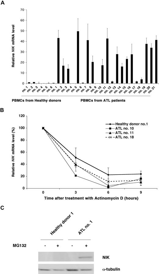 Figure 2. Overexpression of the NIK mRNA and protein in PBMCs from ATL patients. (A) Total RNA was extracted from PBMCs from healthy donors and ATL patients and then subjected to quantitative RT-PCR. The NIK mRNA levels were normalized to 18S RNA. The relative nik mRNA levels shown represent the fold increases in mRNA abundance relative to that of healthy donor 1 (arbitrarily set at 1). These data are expressed as the mean plus or minus SD of 3 independent experiments. (B) PBMCs were cultured in the presence of actinomycin D (5 μg/mL) for the times indicated, and then total RNA was isolated and subjected to quantitative RT-PCR. The relative amounts of NIK mRNA shown represent the percentages in mRNA abundance, relative to that of PBMCs before the addition of actinomycin D (arbitrarily set at 100%). (C) PBMCs from a healthy donor and an ATL patient were treated with (+) or without (−) MG132 (20 μM) for 3 hours, lysed with RIPA buffer, and subjected to immunoblotting with anti-NIK or anti-α-tubulin antibodies.
