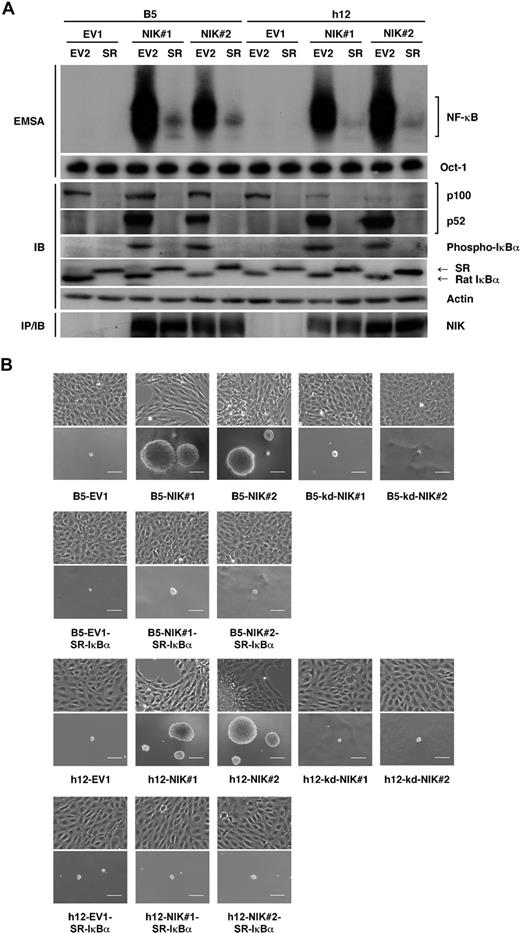Figure 5. The overexpression of NIK transforms rat fibroblasts in an NF-κB–dependent manner. (A) Top 2 panels: 5 μg of nuclear extracts prepared from B5 and h12 cells transduced with empty vector (EV2) or SR-IκBα (SR) were analyzed by EMSA, using NF-κB and Oct-1 probes. Middle 5 panels: whole-cell extracts (30 μg) of B5 or h12 infectants were subjected to SDS-PAGE and immunoblotting with anti-p52, antiphospho-IκBα, anti-IκBα, or antiactin antibodies. Bottom panel: HA-tagged NIK was immunoprecipitated from B5 and h12 infectants with anti-HA antibody and detected by immunoblotting with anti-NIK antibody (H-248). (B) Phase-contrast micrographs of cells cultured on monolayers (top images) or in soft agar (bottom images). B5 or h12 cell clones expressing wild-type NIK (NIK#1 and NIK#2) or not (EV1) were cultured in soft agar for 3 weeks. These cells were further transduced with SR-IκBα, and then pooled cells were assayed for anchorage-independent growth in soft agar. B5 and h12 cell clones expressing kd-NIK were also examined. Original magnification ×100. Scale bar represents 100 μm. SR indicates super-repressor; kd-NIK, catalytically inactive NIK; IB, immunoblotting; IP, immunoprecipitation.
