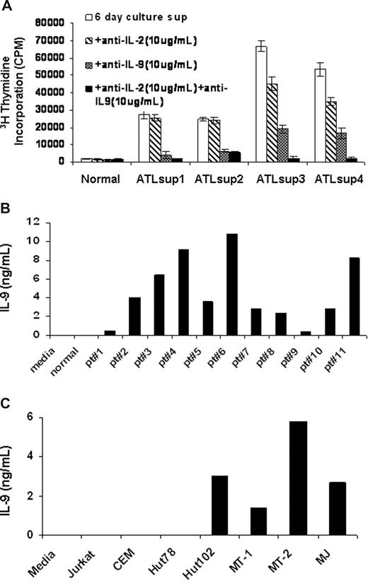 Figure 1. IL-9 was secreted into the supernatants of ATL PBMCs and HTLV-I–infected cell lines. (A) NK-92 cell line assay of 6-day culture supernatants of PBMCs from smoldering and chronic ATL patients were performed. Monoclonal antibodies to IL-2 or IL-9 or to both were added to the assay to detect the presence of IL-2 or/and IL-9 in the 6-day culture supernatants. The normal control was typical of that observed from 10 normal donors. (B) IL-9 ELISA was performed to define the IL-9 levels in the 6-day culture supernatants of PBMCs from 11 patients with ATL. The growth medium and the supernatants from normal donor PBMCs culture were used as a control (n = 10, patient vs control, P < .001). (C) An IL-9 ELISA was performed to determine the IL-9 levels in the culture supernatants of HTLV-I–infected cell lines Hut102, MT-1, MT-2, and MJ as well as HTLV-I–negative cell lines Jurkat, CEM, and Hut78.