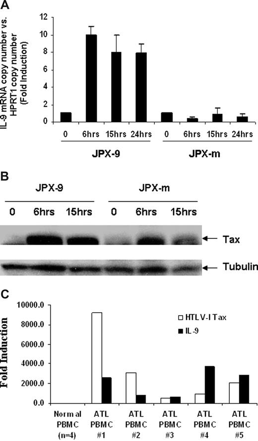 Figure 2. HTLV-I Tax-transactivated IL-9 expression in Jurkat T cells. (A) IL-9 mRNA levels after Tax induction were detected by Taqman real-time PCR. The copy number of IL-9 mRNA was normalized by the copy number of hypoxanthine guanine phosphoribosyl transferase 1 (HPRT1) mRNA. The data are representative of 3 independent experiments. (B) Western blot analysis using a monoclonal antibody to Tax for relative expression of wild-type HTLV-I Tax (JPX-9) and nonfunctional mutant Tax (JPX-m) in JPX-9 and JPX-m before and after addition of 20 μM CdCl2. (C) Taqman real-time analysis of HTLV-I Tax and IL-9 message in ATL PBMCs ex vivo cells.