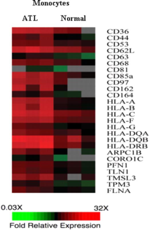 Figure 7. Genes encoding adhesion molecules, MHC class I and class II, and cytoskeleton binding proteins were up-regulated in monocytes derived from ATL patients. The gene expression of monocytes from 3 ATL patients were compared with the gene expression of monocytes derived from 3 normal healthy donors. The monocytes were purified using negative selection. cDNA from ATL monocytes or normal monocytes was labeled with Cy5 and hybridized with human universal reference cDNA labeled with Cy3. Red indicates Cy5/Cy3 ratio more than 1, green indicates Cy5/Cy3 ratios less than 1, black indicates no significant change in gene expression, and gray indicates the spot did not meet data selection criteria. These ratios were depicted according to the color scale shown at the bottom. Three sets of functional related genes, including genes encoding adhesion molecules, MHC class I and MHC class II gene, and genes encoding cytoskeleton binding proteins, which had at least 2-fold increases in the ATL monocytes.
