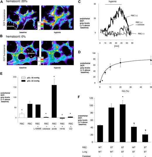 Figure 1. Endothelial ROS in lung microvessels in situ. (A,B) Color-coded endothelial DCF fluorescence in venules (V) and septal capillaries (S) under normoxic (left) and hypoxic (right) conditions. Vessel margins are depicted (white lines). The alveolar septum is indicated (arrows). Venules were given RBC-containing perfusion at indicated hematocrits. (C) Tracings of DCF fluorescence intensity from an identical endothelial cell at baseline and hypoxic conditions. Perfusate was RBC-free or RBC-containing (hematocrit, 20%) with or without catalase (50 U/mL) replicated 5 times. (D) Hematocrit (Hct) dependency of endothelial DCF fluorescence. Data obtained after 30 minutes of hypoxia are mean plus or minus SE (n = 4 each point; *P < .05 vs hematocrit of 20%). (E) Group data are for hypoxia-induced responses in venules given RBC-containing perfusions (hematocrit, 20%). The unfilled bar corresponds to pO2 of 40 mmHg attained after 17 minutes of hypoxia. The bar immediately to the right corresponds to pO2 of 21 mmHg at 30 minutes of hypoxia exposure. For the other bars, RBCs were perfused together with catalase (50 U/mL) or RBCs were pretreated with the indicated agents (L-NAME, 250 μM; azide, 1 mM; nitrite, 5 mM). Data are mean plus or minus SE; n = 5 for each bar (*P < .05 vs untreated RBC perfusion at pO2 of 21 mmHg, hematocrit of 20%). (F) Data are for venules after 30 minutes of hypoxia. RBC indicates RBCs from wild-type (WT) and BERK-trait (BT) mice were perfused (hematocrit, 20%) in WT and BT lungs as indicated. Catalase (50 U/mL) was included in the perfusion as indicated. Data are mean plus or minus SE; n = 5 for each group (*P < .05 vs first bar; §P < .05 vs 3rd bar).