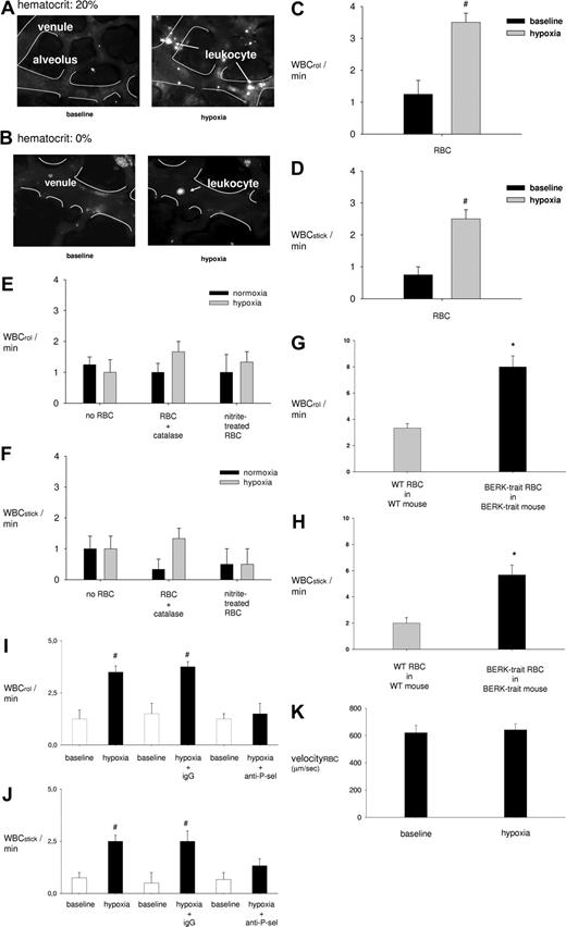 Figure 5. Leukocyte-endothelial cell interactions in lung capillaries. (A,B) Images show rhodamine-6G–labeled leukocytes (white dots) in venular capillaries margins of which are outlined (white lines). At hematocrit of 20%, whereas few leukocytes adhere to the venular endothelium under baseline conditions (top left), leukocyte attachment to the endothelium is greater after 30 minutes of hypoxia (top right). By contrast, at hematocrit of 0% hypoxia causes no leukocyte adhesion (bottom right). (C-K) Group data show leukocyte rolling (WBCrol/min) and sticking (WBCstick/min) rates and RBC velocity (k) for normoxia (baseline) and after 30 minutes of hypoxia (hypoxia) under the indicated conditions. Vessels were perfused at 20% hematocrit except as indicated. anti–P-sel indicates P-selectin mAb. #P < .05 vs baseline (panels C,D,I,J); *P < .05 versus WT-RBC in WT-lung (1st bar, panels G,H).