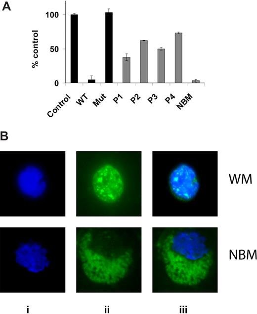 Figure 1. Baseline NF-κB expression in WM cells. (A) NF-κBp65 DNA binding activity was assessed in vitro using nuclear extracts using the Active Motif assay. We compared BM isolated CD19+ cells from 4 patients with WM to one healthy donor. Jurkat nuclear extracts provided as a positive control in the kit were used as a control in the first 3 conditions. P indicates patient; NBM, healthy donor normal BM. WT and Mut are wild-type and mutated consensus competitor oligonucleotides, respectively. Data represent mean plus or minus SD of triplicate experiments. (B) Immunofluor-escence for phospho-NF-κBp65 on BM isolated CD19+ cells from one patient with WM compared with one healthy donor (NBM). Immunocytochemical analysis was assessed using anti–p-NF-κBp65 antibody (ii). DAPI was used to stain nuclei (i). (iii) The merge of i and ii panels.