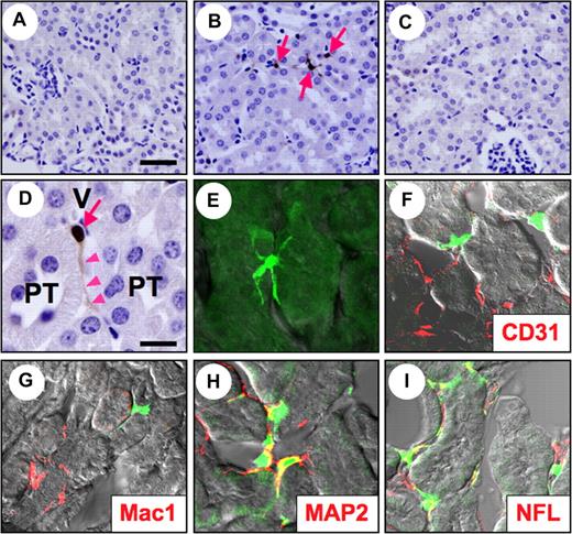 Figure 2. Morphology of renal Epo-producing (REP) cells expressing the wt-Epo-GFP transgene. Immunohistochemical staining was carried out with anti-GFP antibody of normal (A) and anemic (B-D) mouse kidneys from transgenic line WA (A,B,D) and wild-type (C) mice. GFP expression (brown) was detected in the peritubular interstitial cells (arrows in B,D) with long projections (arrowheads in D) between the proximal tubules (PT) and vessels (V). Fluorescent images of REP cells from anemic kidneys of transgenic mice (line WA) taken with the confocal laser scanning microscope (E-I). When costained with cell lineage markers (red), REP cells (green) were negative for CD31 (F) and Mac1 (G), but positive for MAP2 (H) and NFL (I). Scale bars represent 50 μm (A-C) and 10 μm (D-I).