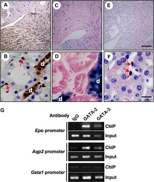 Figure 6. Expression of GATA factors in renal tubular cells and binding of the Epo gene to the GATA box promoter. (A,B) Immunohistochemical staining of GFP in the kidney of a Gata2-GFP knock-in mouse. (C,D) X-gal staining in the kidney of a Gata3-LacZ knock-in mouse. (E,F) Immunohistochemical staining with anti–GATA-4 antibody in the kidney of wild-type mouse. Note that the distal tubules (d) and collecting ducts are positive for both Gata2-GFP (brown) and Gata3-LacZ (blue), but negative for GATA-4. On the other hand, the expression of Gata2-GFP and GATA-4 was detected in REP cells (arrows in B,F). (G) Chromatin immunoprecipitation (ChIP) assays of GATA-2 and GATA-3 and the Epo promoter. Chromatin complexes from the normal renal medulla were immunoprecipitated with anti–GATA-2 or anti–GATA-3 antibodies and the presence of Epo, Aqp2, and Gata1 gene promoter fragments was examined by PCR. Preprecipitated samples (input) were used as the internal positive controls for PCR. Normal rabbit immunoglobulin G (IgG) was used as a negative control. Scale bars are 300 μm (A,C,E) and 20 μm (B,D,F).