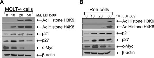 Figure 4. LBH589 induces hyperacetylation of histones H3K9 and H4K8, and modulates expression of cell-cycle control genes. Cells were treated with indicated concentrations of LBH589 for 24 hours. After this, Western blot analyses of acetylated histones H3K9 and H4K8, p21, p27, and c-Myc were performed on the cell lysates from MOLT-4 cells (A) and Reh cells (B). The levels of β-actin served as loading control. Results are representative of 3 independent experiments.